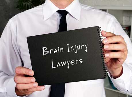 4 Things You Probably Don’t Know About Brain Injury Lawyers