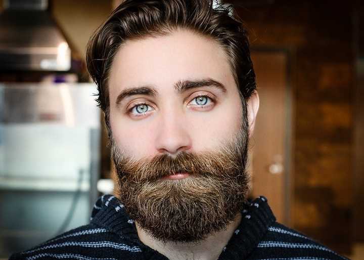 Beard Transplant, The Procedure and What You Should Expect