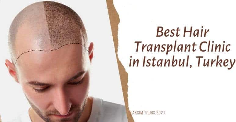 Hair transplant in Istanbul – A detail guide