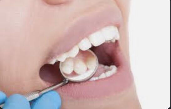 Protecting Your Smile