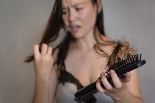 How to Address Hair Loss in Teenagers?