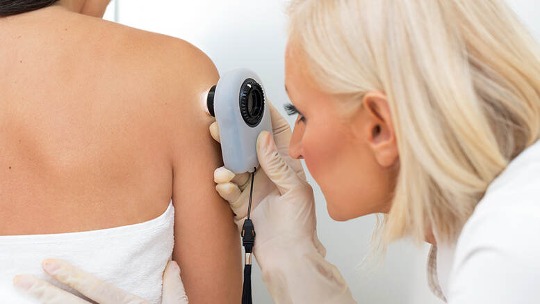 Mole Mapping Technology: How It Is Changing Skin Cancer Detection in Australia